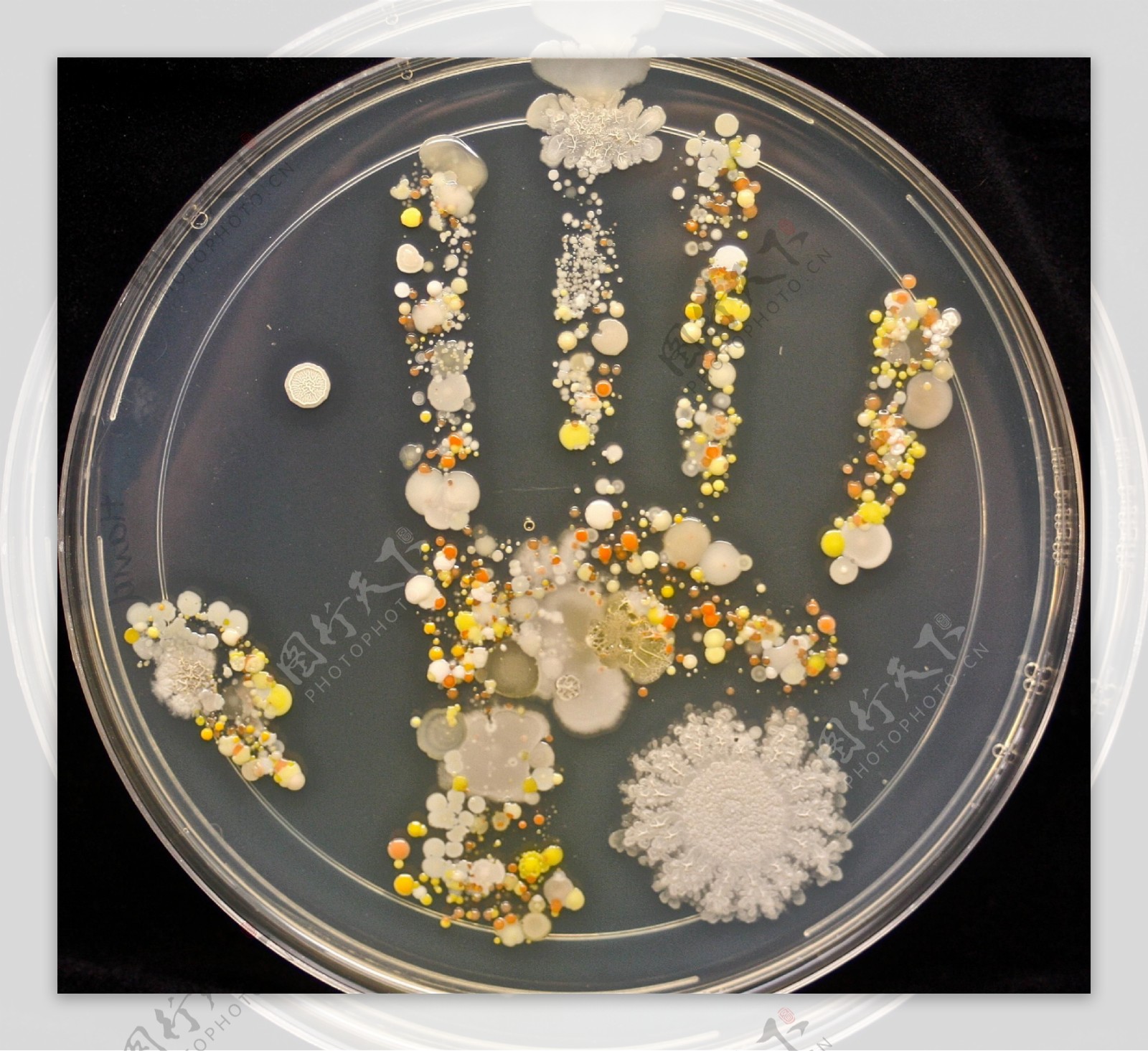 手掌细菌图片