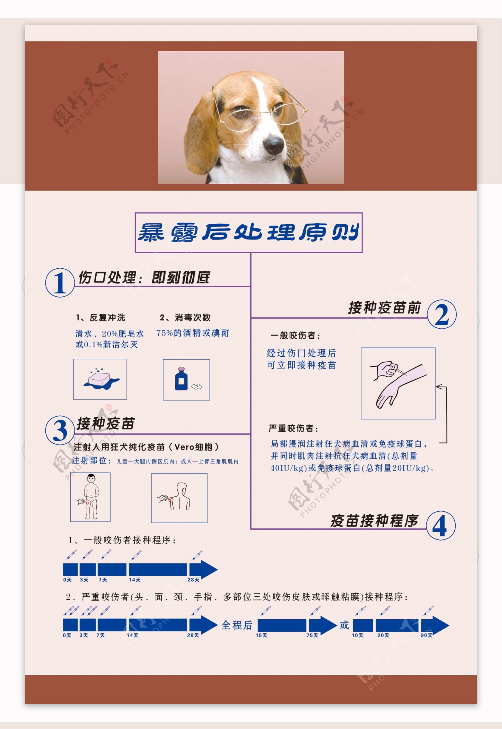 暴露后处理原则图片