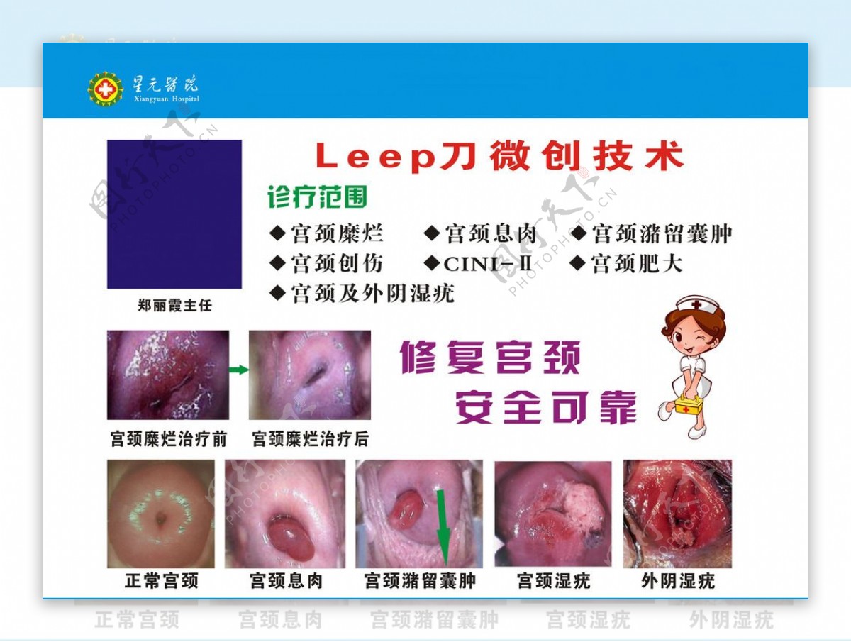 Leep刀微创技术图片