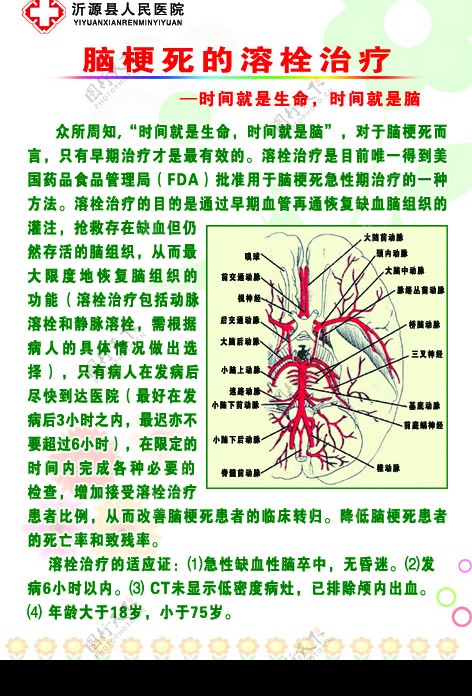 脑梗死的溶栓治疗图片