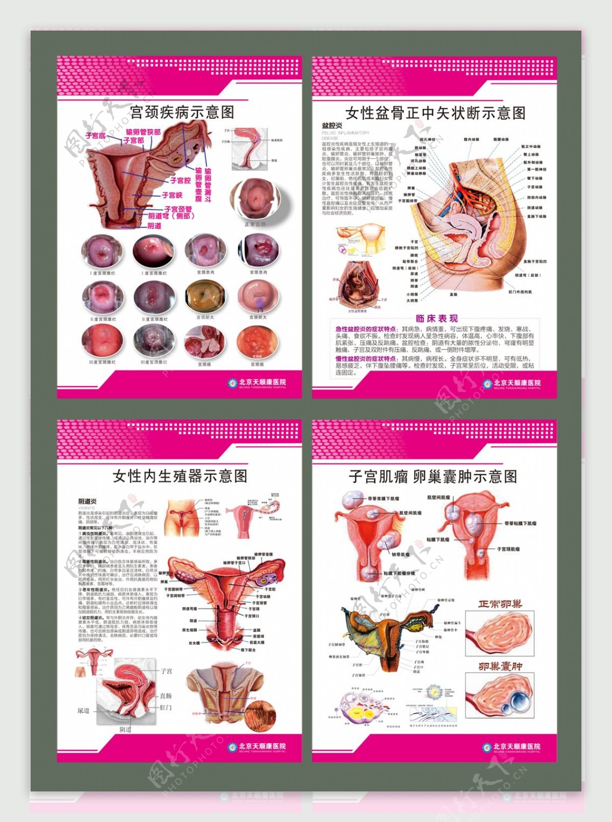 女性生殖系统挂图