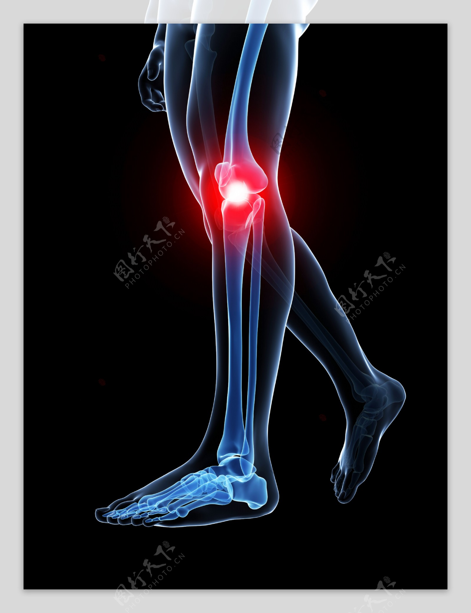 膝关节痛图片