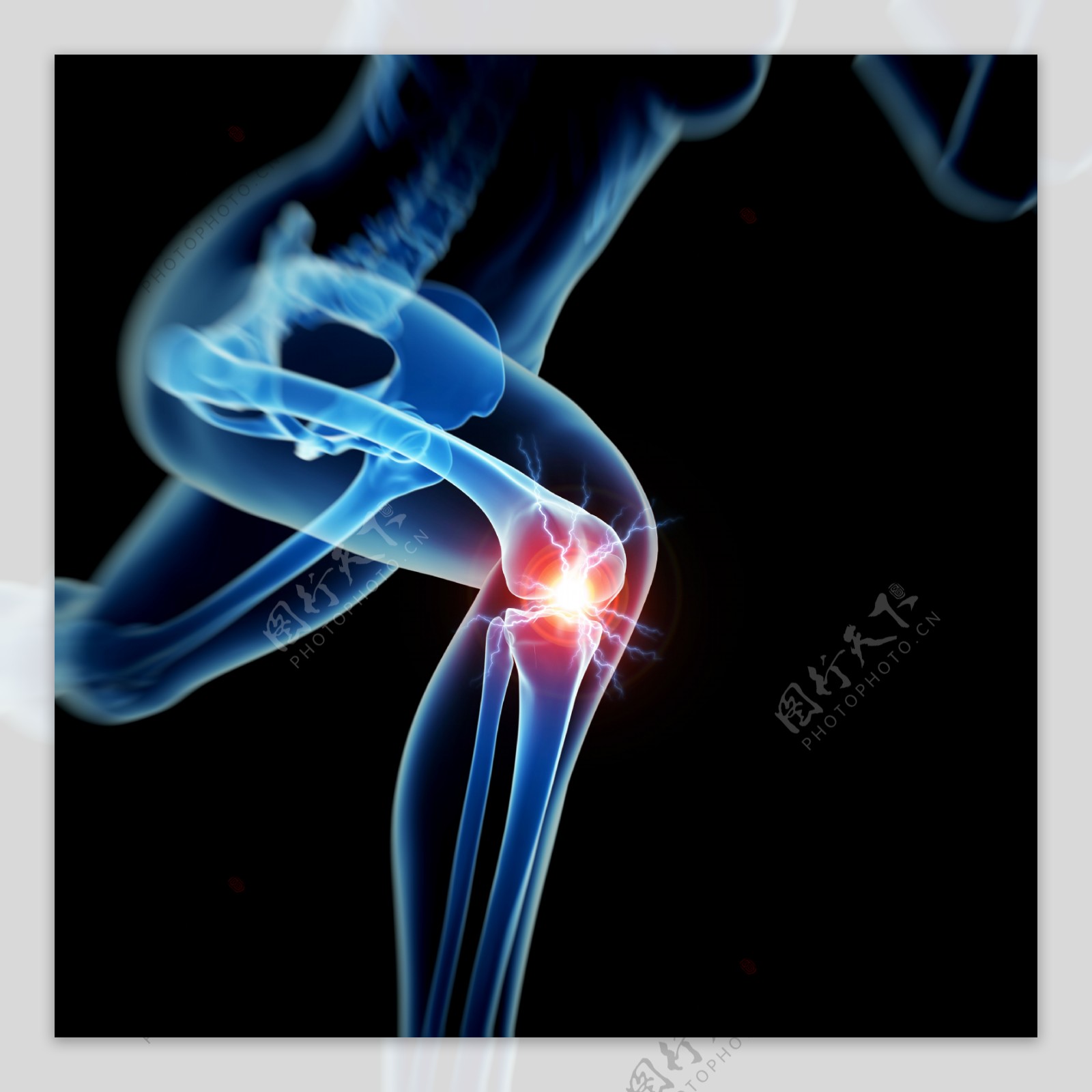 人体膝关节疼痛图片