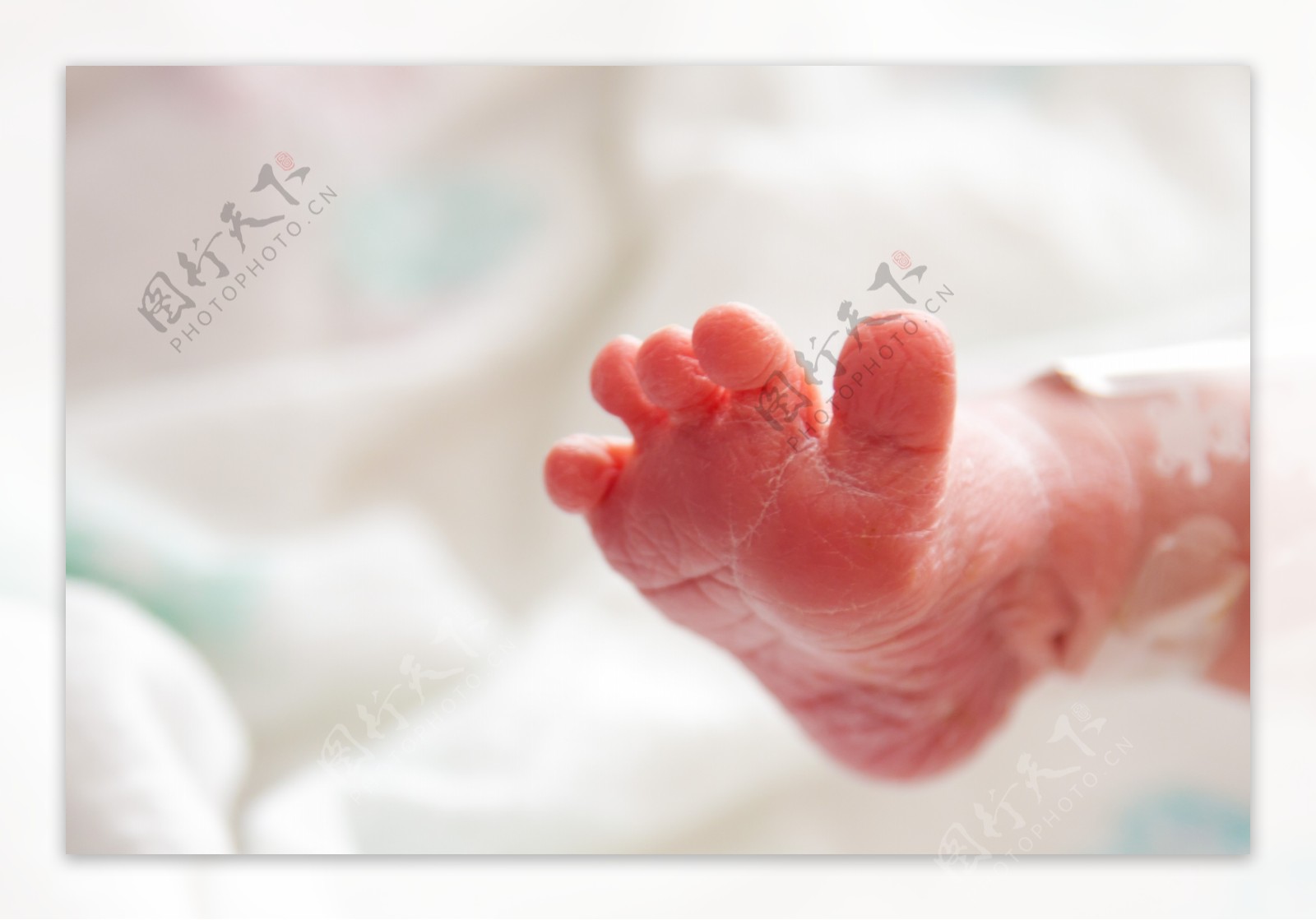 新生儿的小脚丫图片