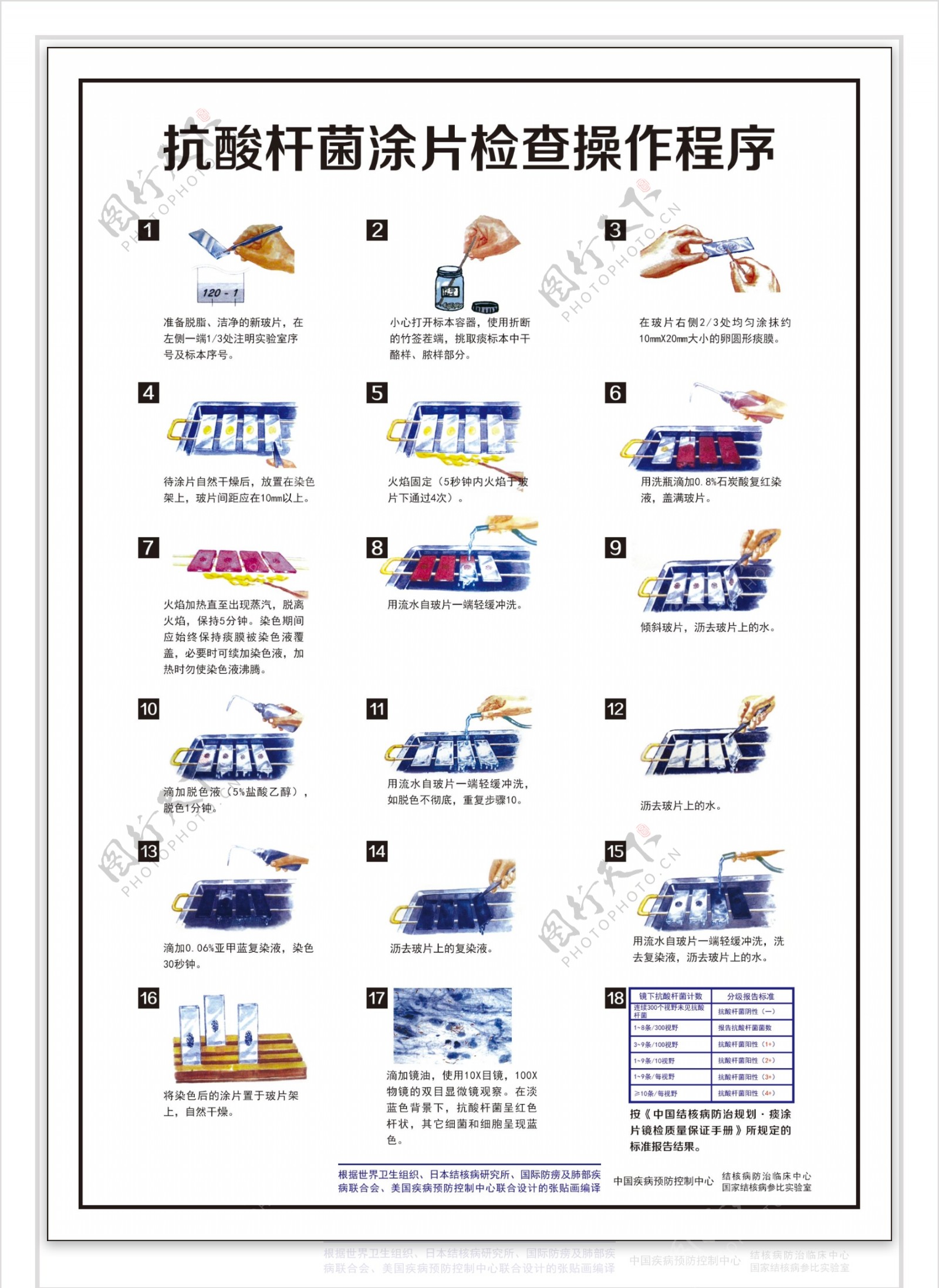 抗酸杆菌涂片检查操作程序