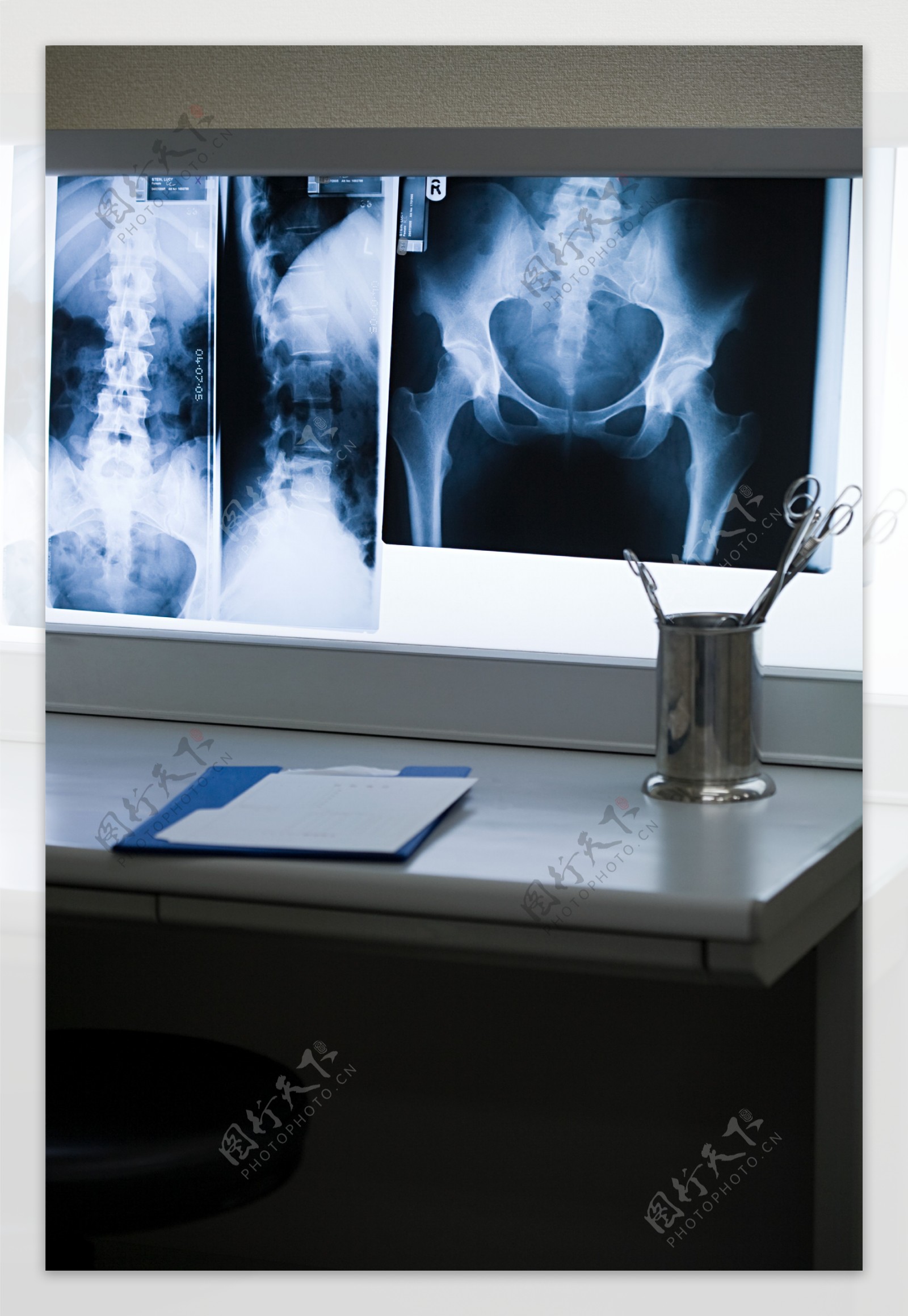 医疗X光片特写图片
