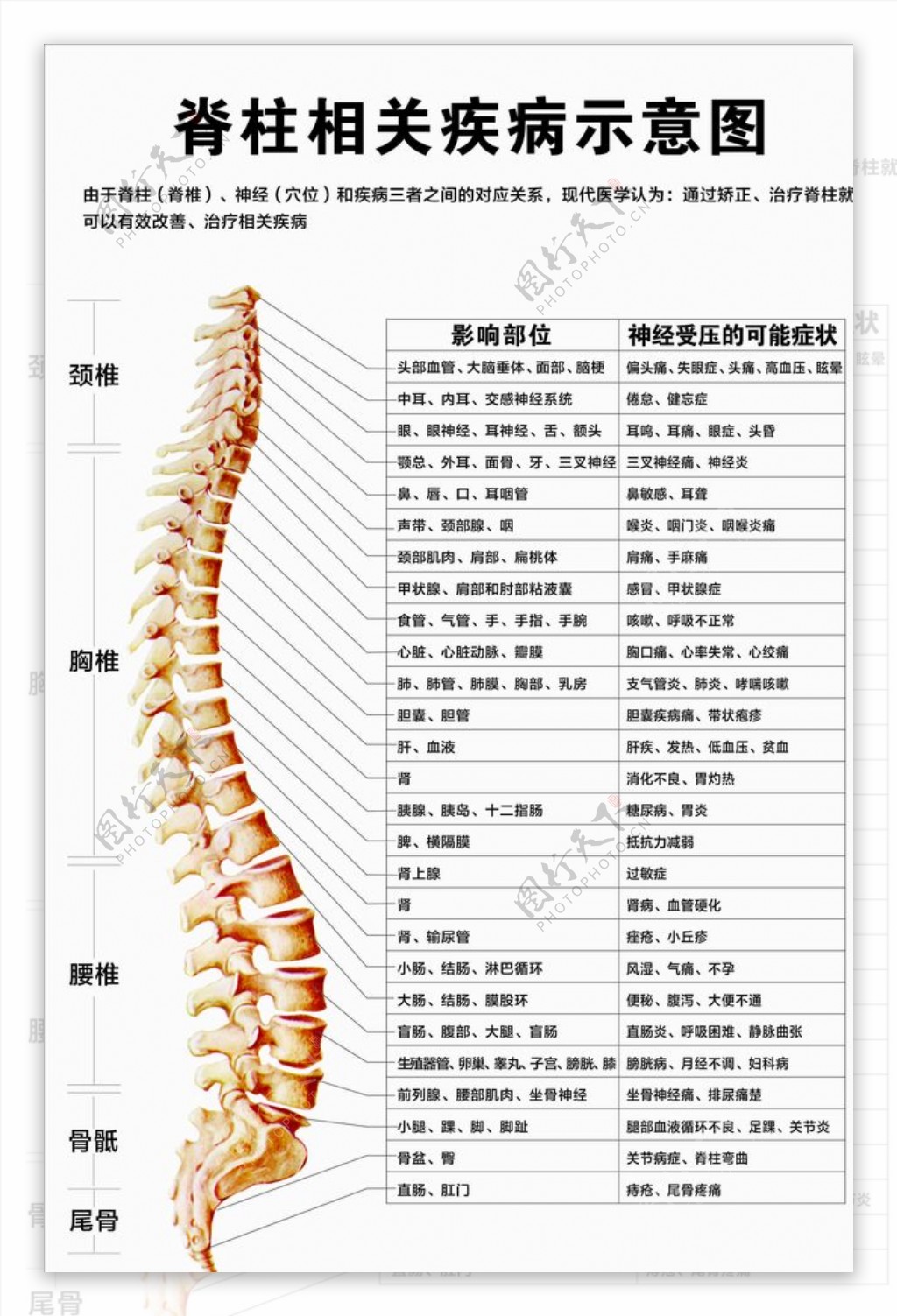 脊柱相关疾病示意图图片